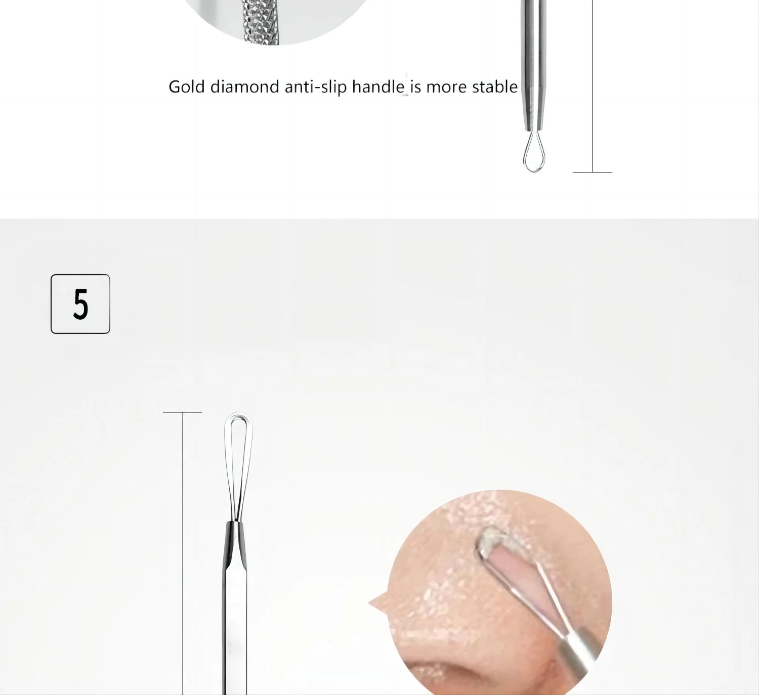 5-Piece Stainless Steel Blackhead and Acne Removal Kit - 17