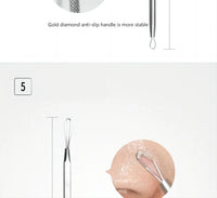 5-Piece Stainless Steel Blackhead and Acne Removal Kit