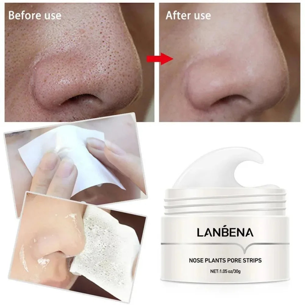 Deep Cleaning Nose Pore Strip Mask for Blackhead Removal - 4