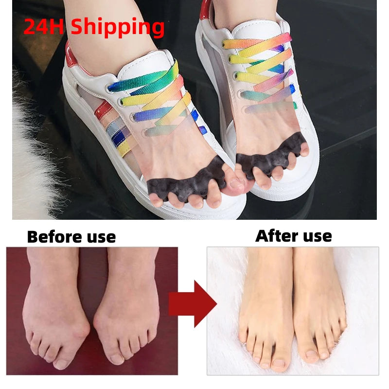 Orthopedic Gel Toe Separator and Bunion Corrector - 2