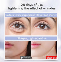 Red Light LED Facial Wand for Anti-Aging and Eye Care