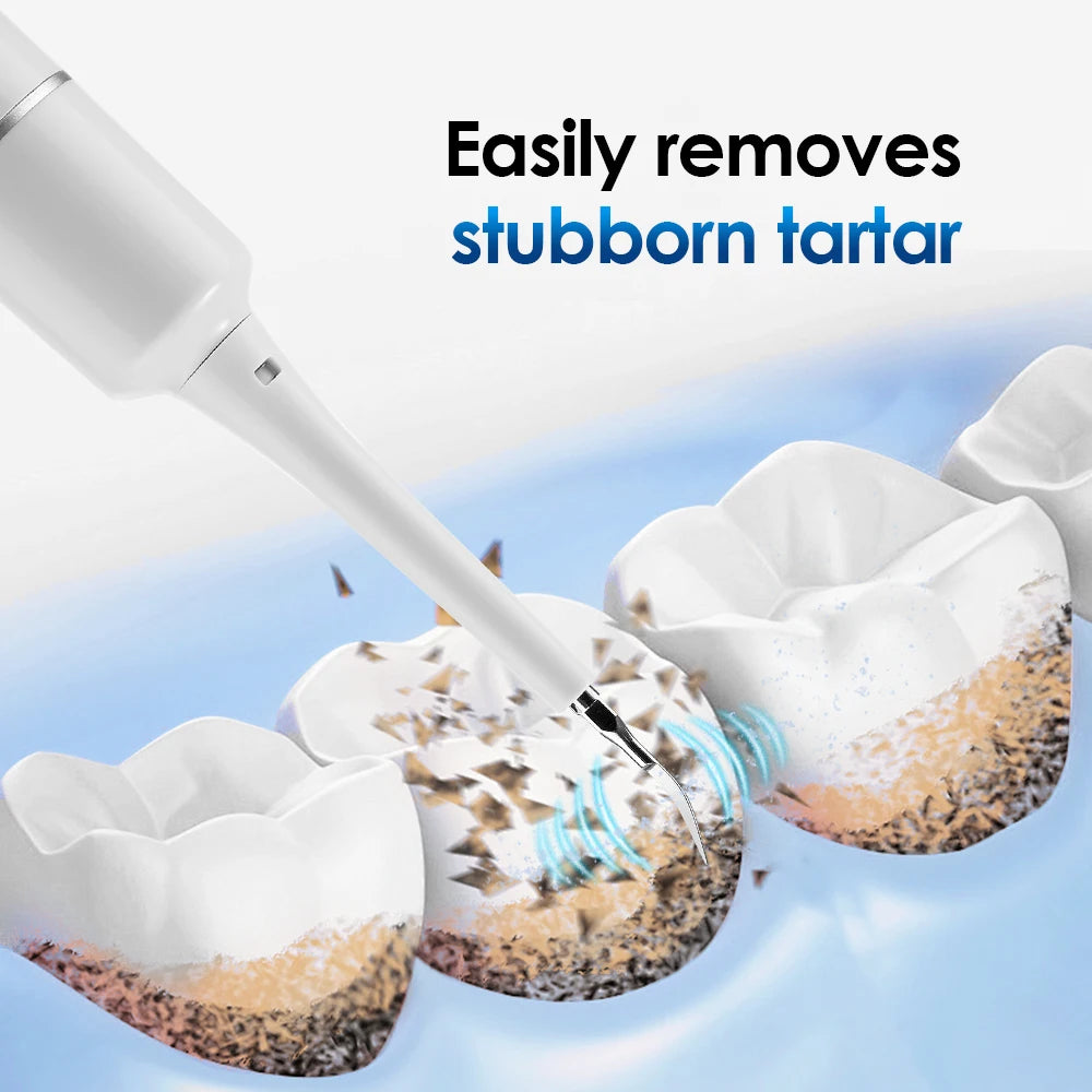 Electric Sonic Dental Calculus Remover & Teeth Whitening Kit - 29
