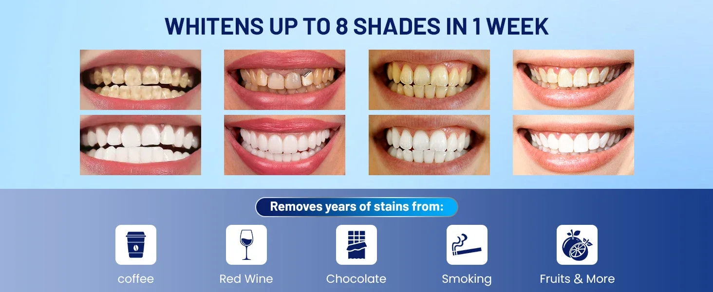 LED Teeth Whitening Kit for Sensitive Teeth - 9