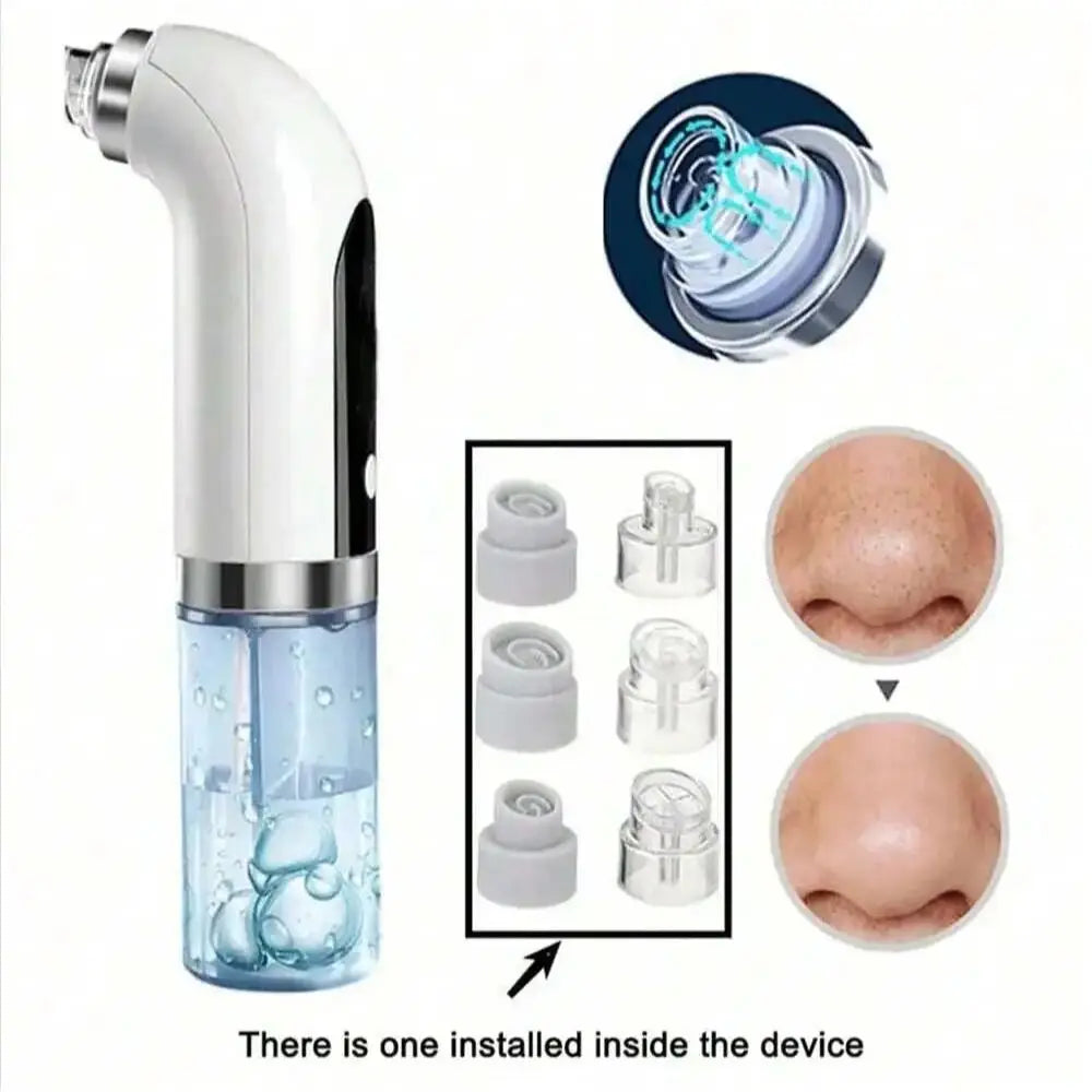 Electric Pore Vacuum and Water Circulation Blackhead Remover - 7