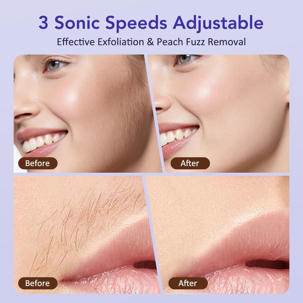 Sonic Rechargeable Facial Dermaplane Razor for Smooth Skin - 15
