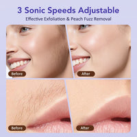 Sonic Rechargeable Facial Dermaplane Razor for Smooth Skin