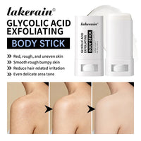 Glycolic Acid Exfoliating Body Treatment Stick