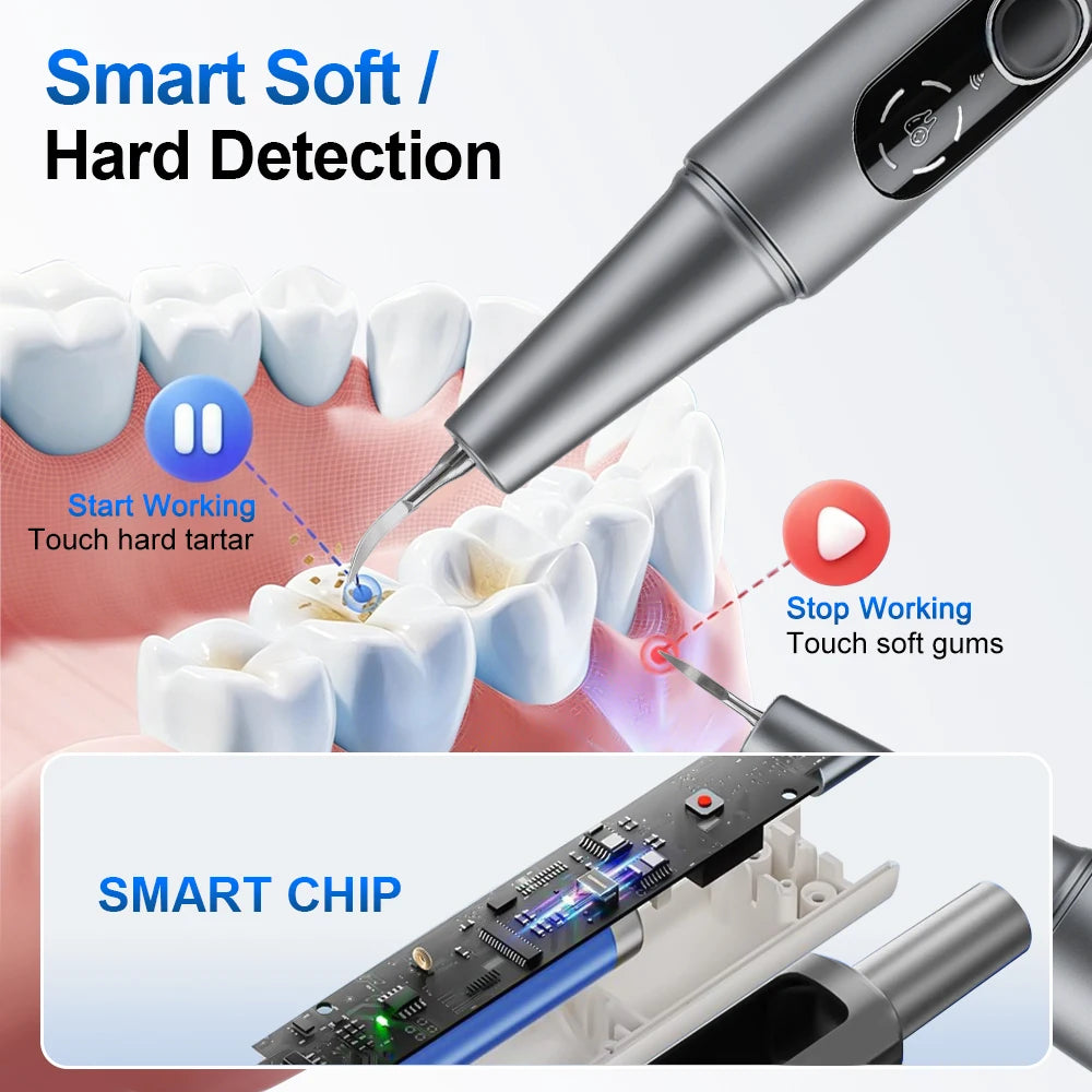 Visual Ultrasonic Tooth Scaler for At-Home Plaque Removal - 11