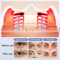 Electric Under-Eye Massager for Puffiness and Wrinkles