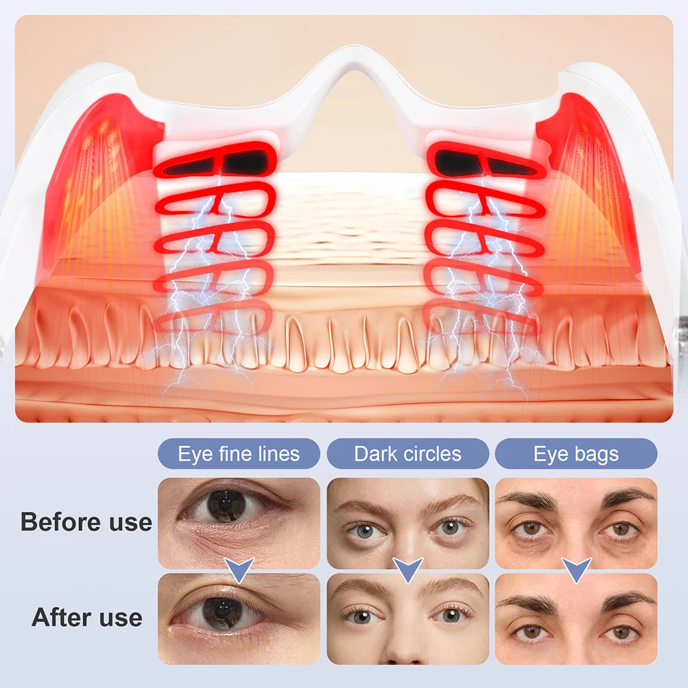 EMS Red Light Eye Massager for Fatigue and Dark Circles - 4