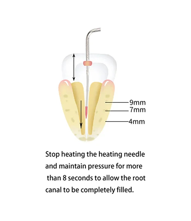 Wireless Dental Gutta-Percha Obturation System - 14