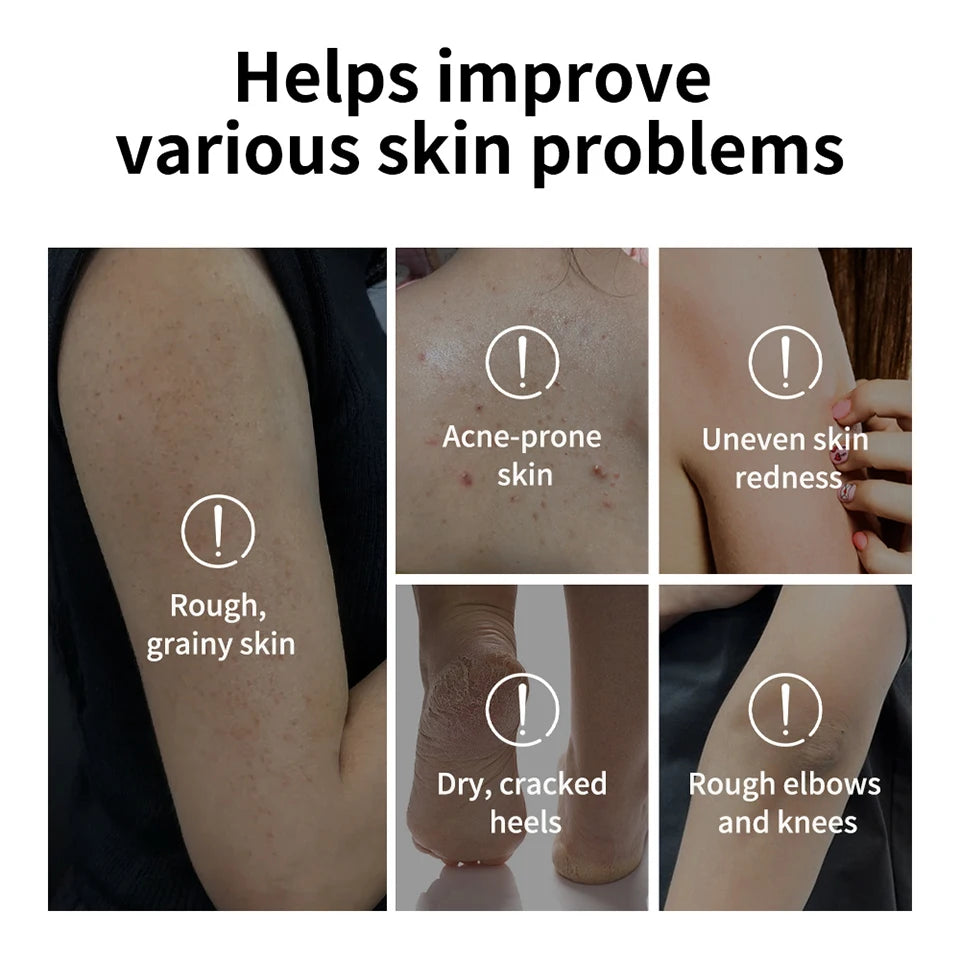 Glycolic Acid Exfoliating Body Treatment Stick - 11