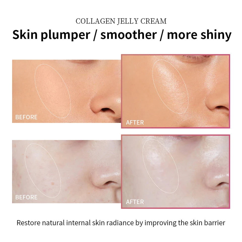 Collagen Jelly Face Cream for Skin Firming and Hydration - 11