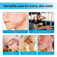 Hypochlorous Acid Soothing Facial Rescue Spray