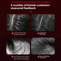 Electric Scalp Massage Comb for Hair Growth & Relaxation