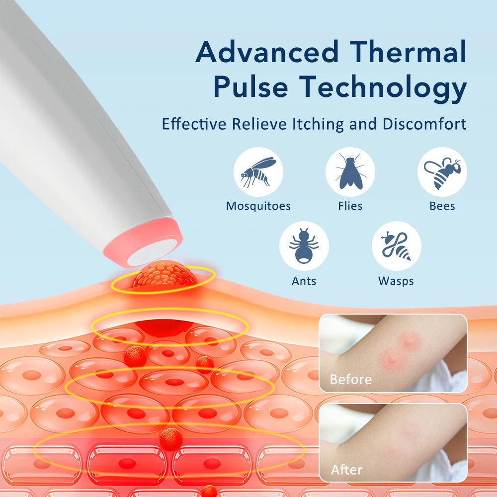Portable Electric Insect Bite Itch Relief Pen - 3