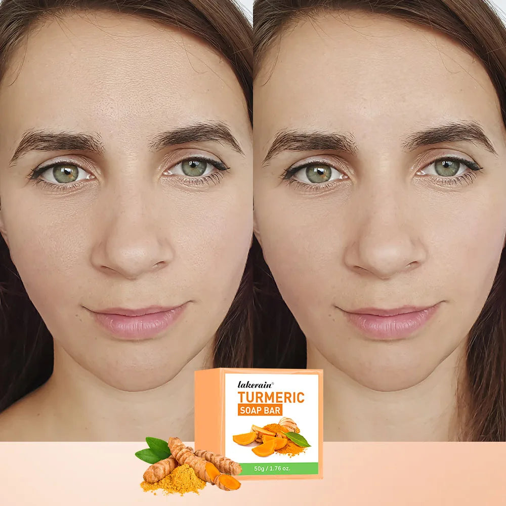Brightening Turmeric Soap Bar for Face and Body - 3