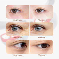 Heated Eye Massager for Fatigue and Dark Circles