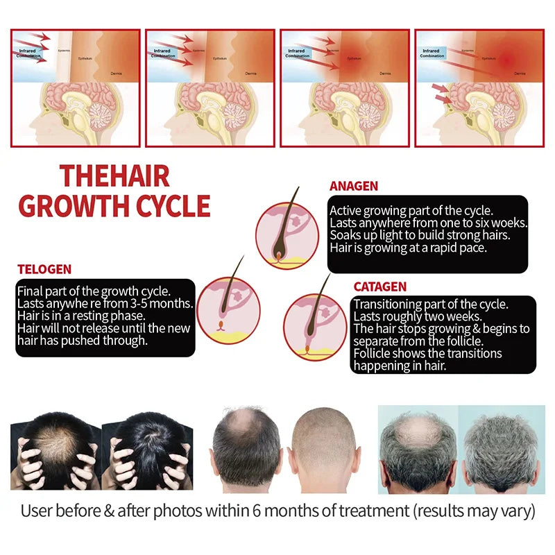 LED Red Light Therapy Cap for Hair Growth - 3