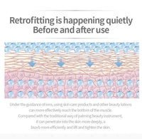 Ultrasonic Facial Skin Scrubber and Pore Cleaner