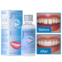Moldable Temporary Tooth Repair Kit for Gaps and Broken Teeth