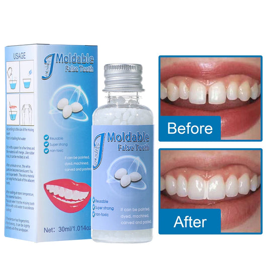Moldable Temporary Tooth Repair Kit for Gaps and Broken Teeth