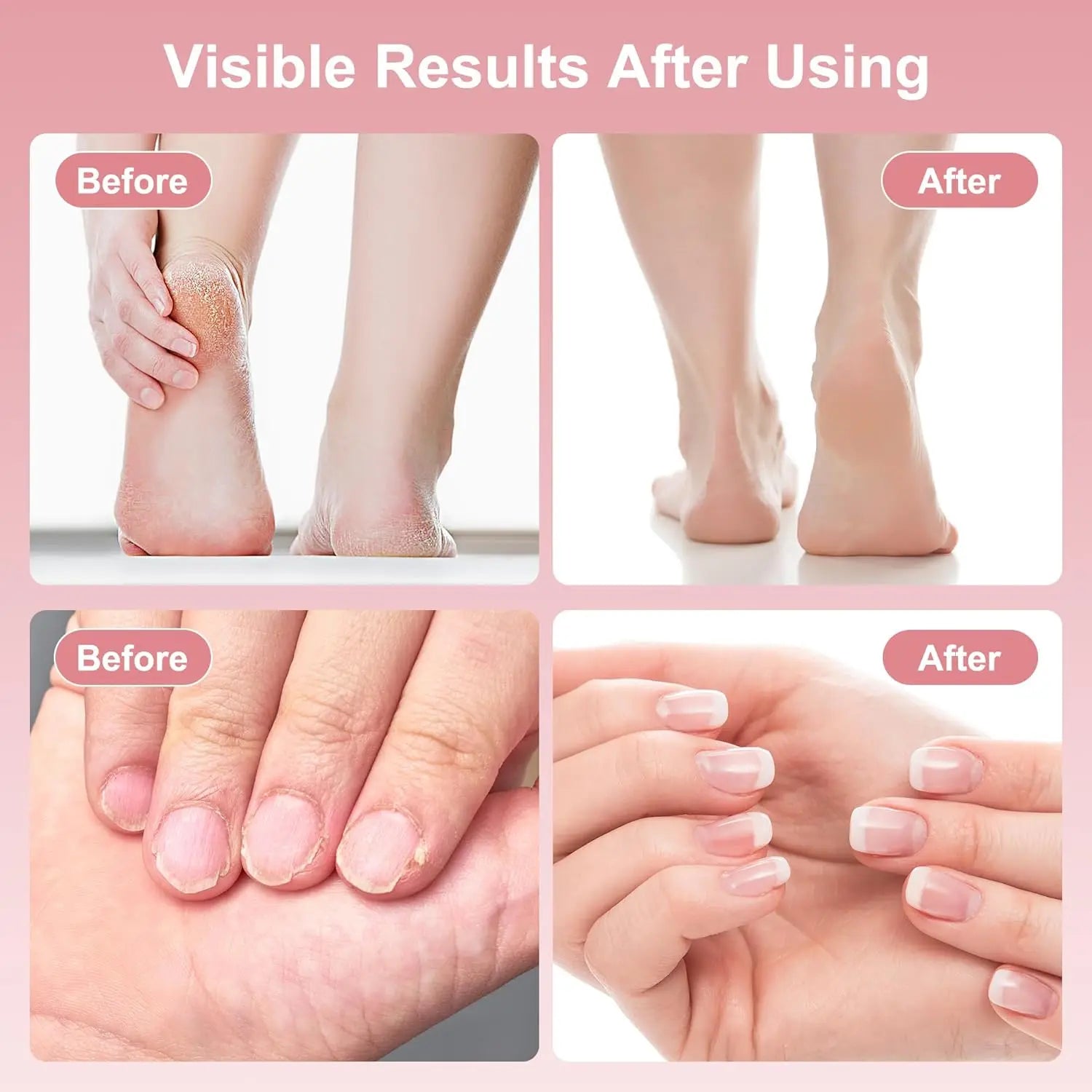 2-in-1 Electric Foot Callus Remover and Nail Polisher - 5