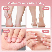 2-in-1 Electric Foot Callus Remover and Nail Polisher